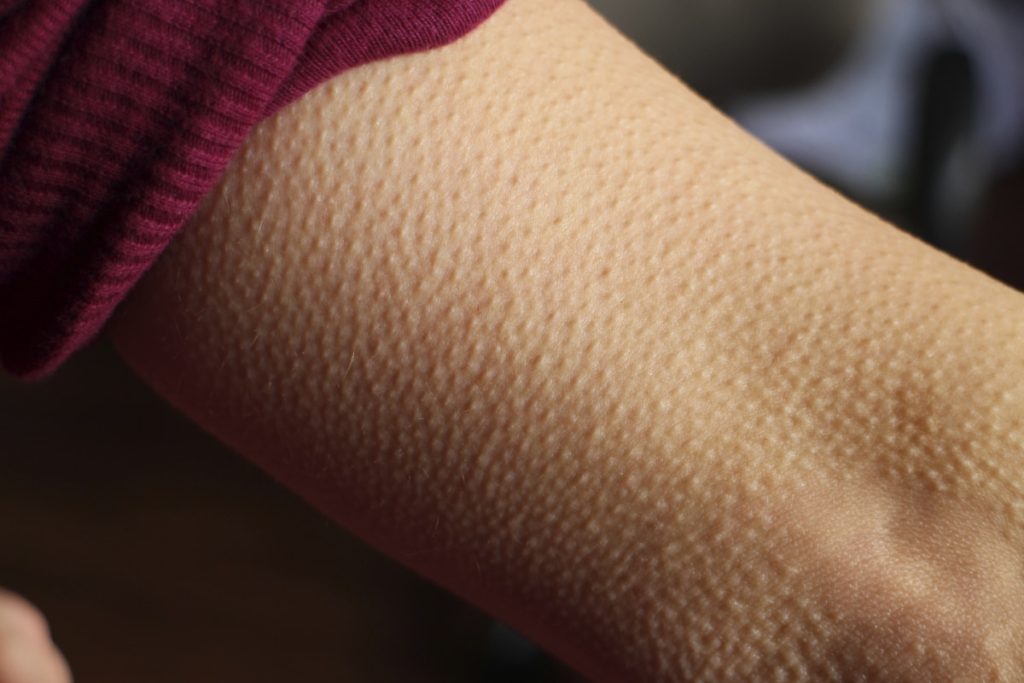 5 steps to a goosebumps worthy presentation